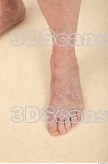 Photo reference of foot 0002